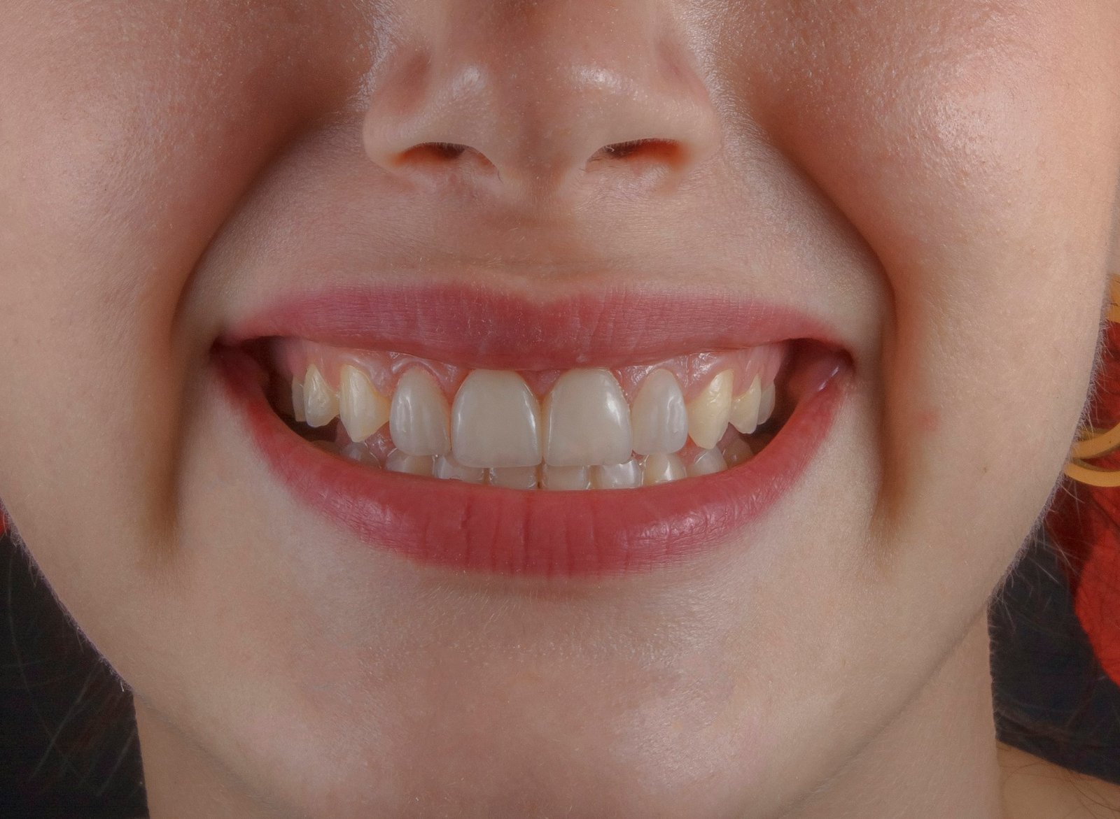 Sorriso saudável